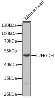 Western Blot: L2HGDH AntibodyBSA Free [NBP3-04540]